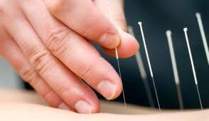 Cabinet de acupunctura - Centrul Shen de Medicina Orientala